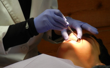 Új fogászati irány: nem a fogat, a csontot kell megmenteni