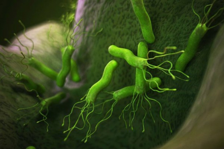 Helicobacter - a gyomorproblémák oka