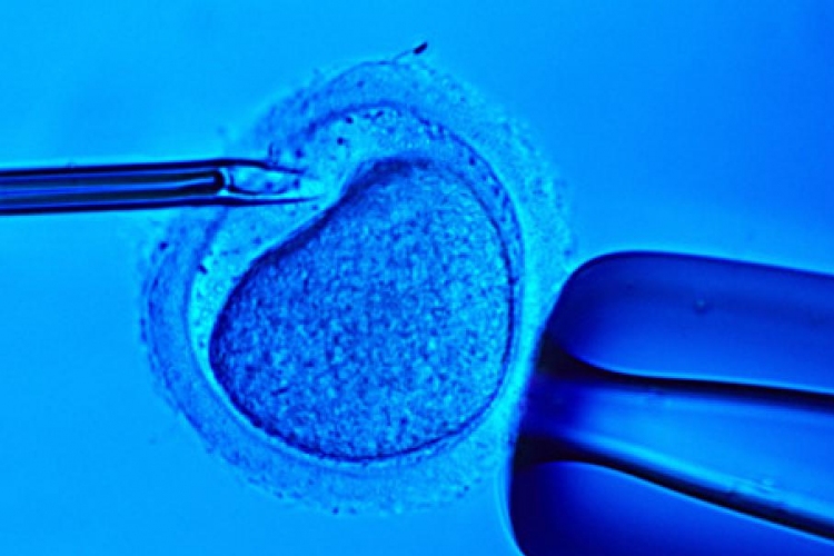Összekeverték 26 párnál a spermákat egy holland lombikbébi-központban