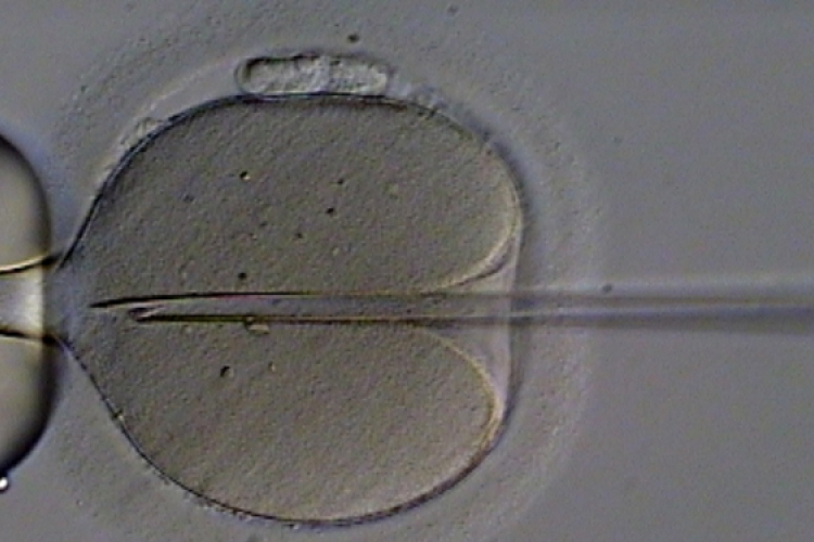 Értelmi fogyatékosságot okozhat az IVF?