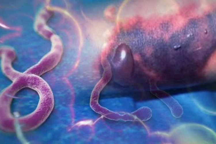 Ebolafertőzéssel zsarolják a cseh államot