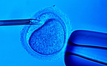Összekeverték 26 párnál a spermákat egy holland lombikbébi-központban